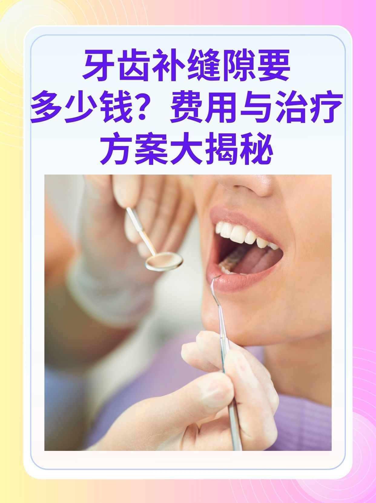 安庆补牙医保可以报销吗(补牙医保可以报销吗 哪些可以报销呢)